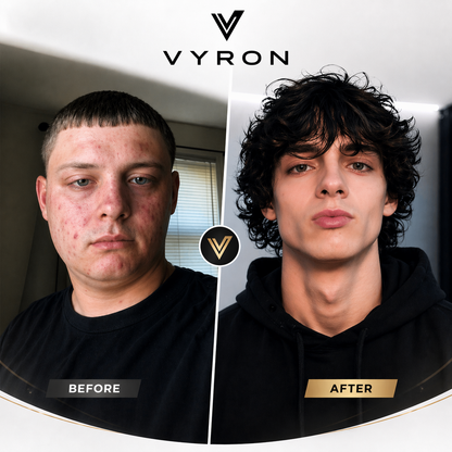 Vyron LooksMaxing Complete Bundle