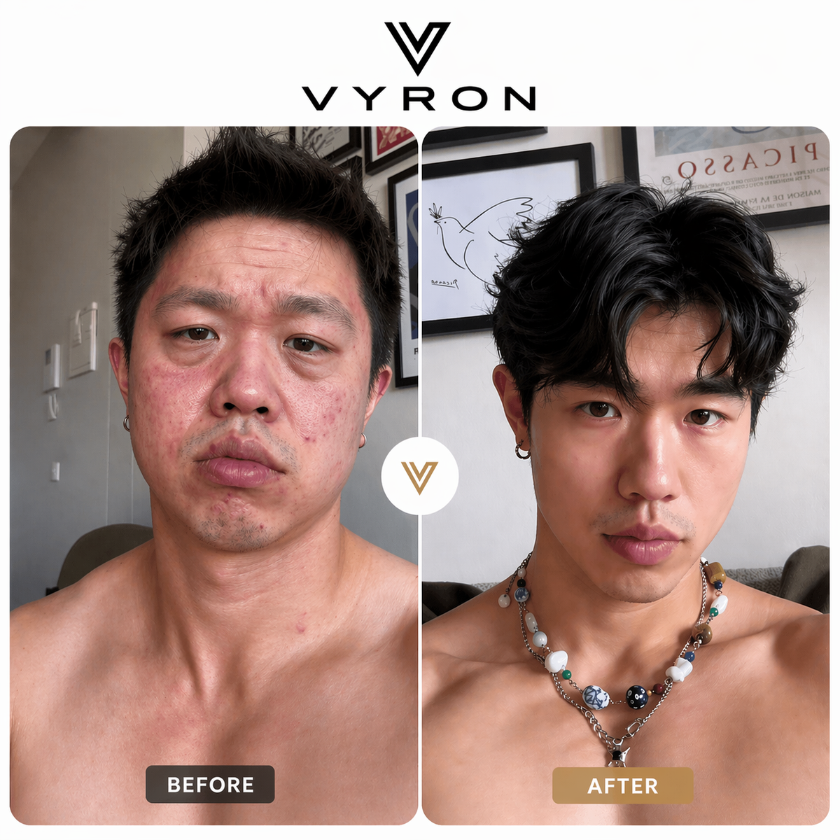 Vyron LooksMaxing Complete Bundle